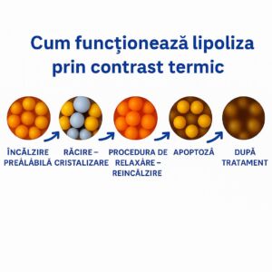 Pachet Duo: Lipoliză cu şoc termic 1 aplicator (pentru tine și prietena ta / prietenul tău)