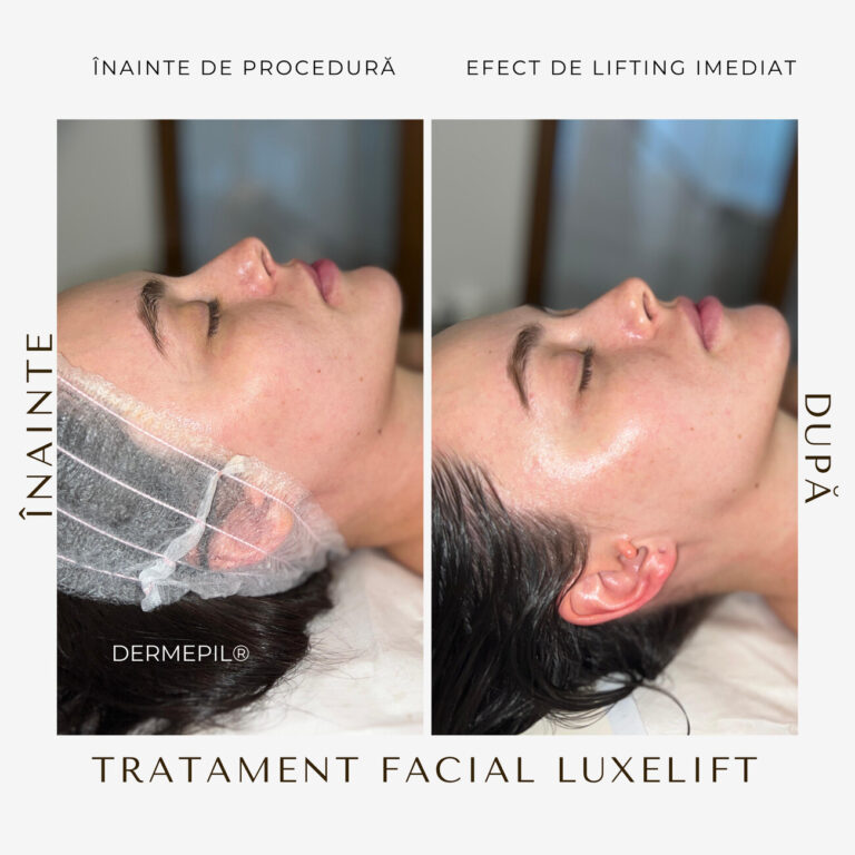 tratament-facial-curatare-9.png.jpg