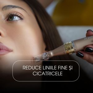 Microneedling cu Acid Hialuronic și Aminoacizi (Față & Gât)