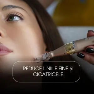 Microneedling cu Acid Hialuronic și Aminoacizi (Față & Gât)