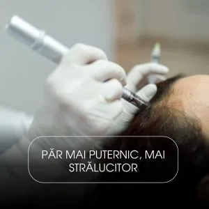 Microneedling Scalp cu Exozomi