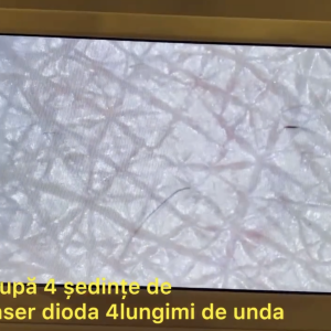 2 Consultații cu Camera Ultra- Zoom