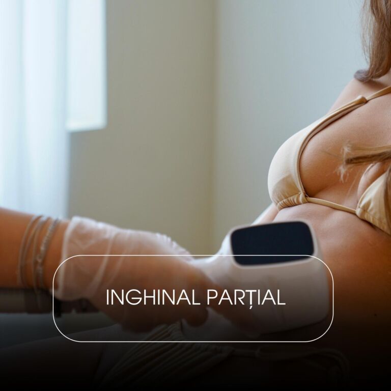 Inghinal Parțial – 3 Lungimi de Undă