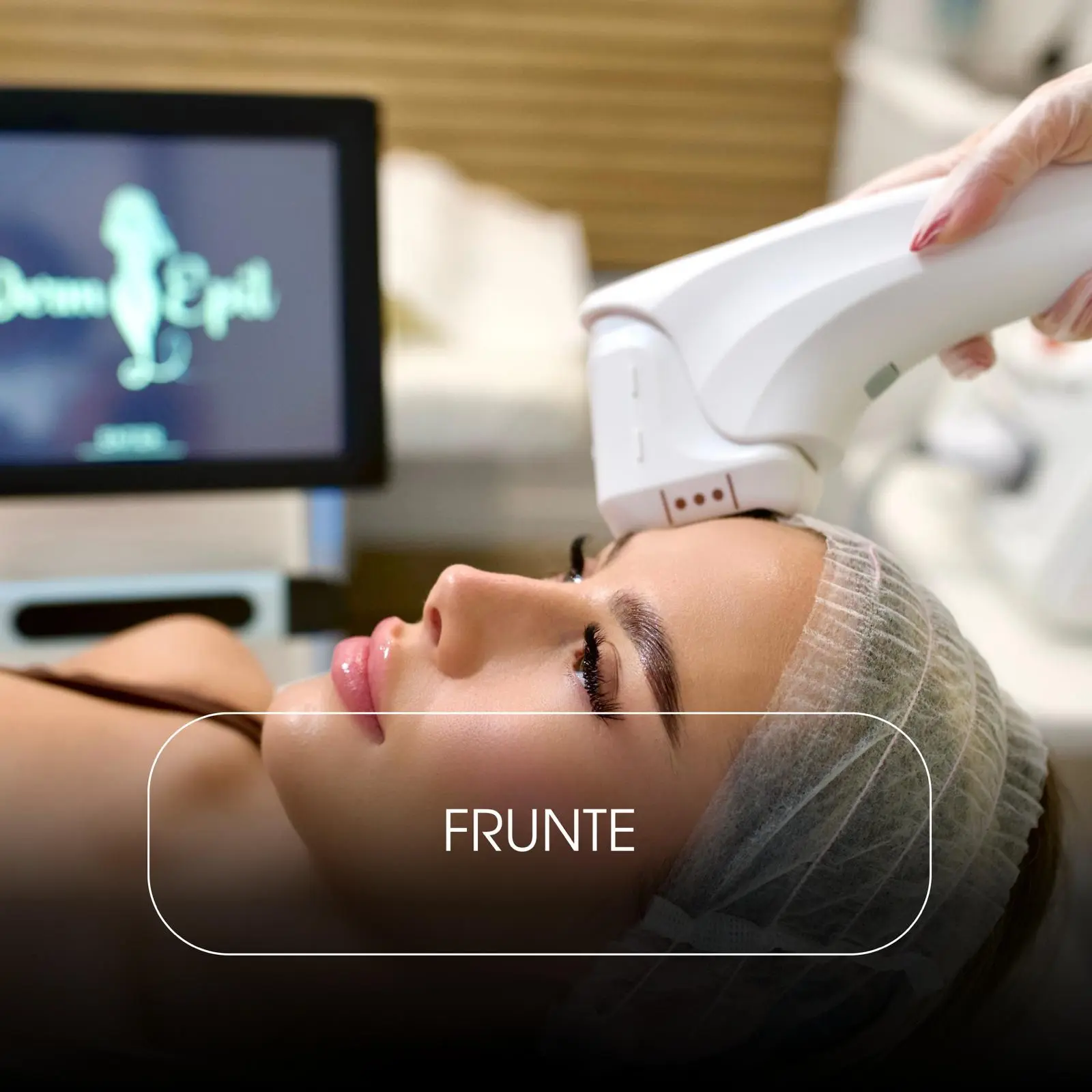 HiFU Frunte