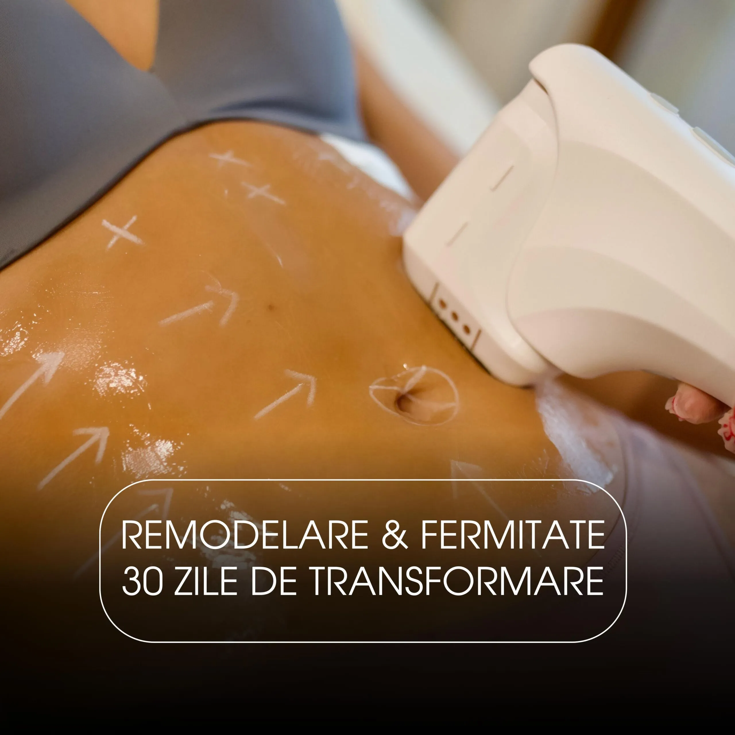 HIFU 3 zone + 4 Împachetari + 4 Electrostimulări