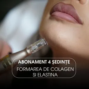 Abonament 4 sedințe Microneedling cu Multivitamine – Față & Gât