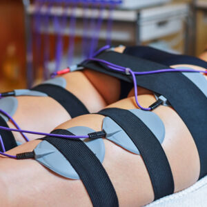Electrostimulare (1 ședință 40 min)