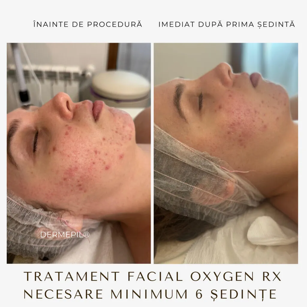 tratament facial curatare 2.png