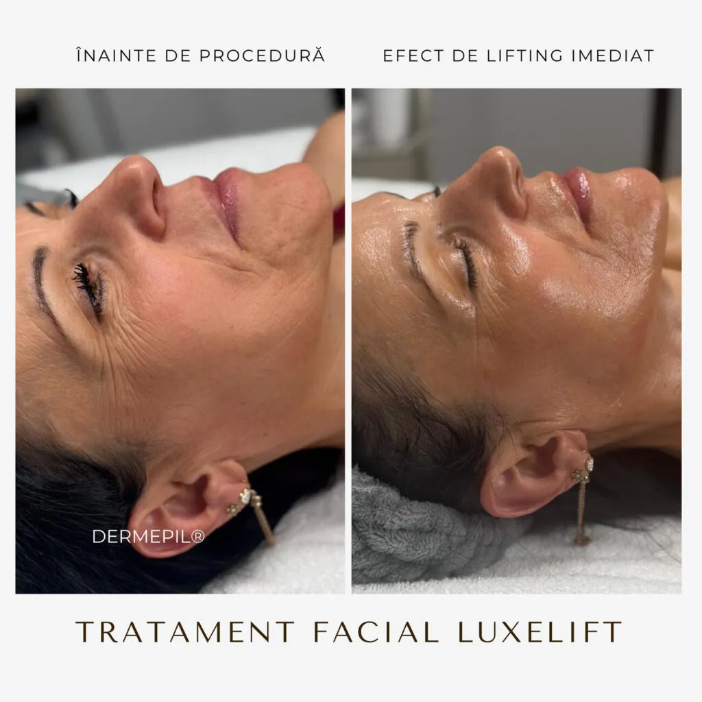 tratament facial curatare 3.png