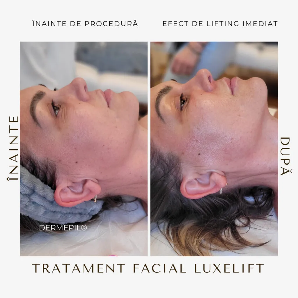 tratament facial curatare 6.png