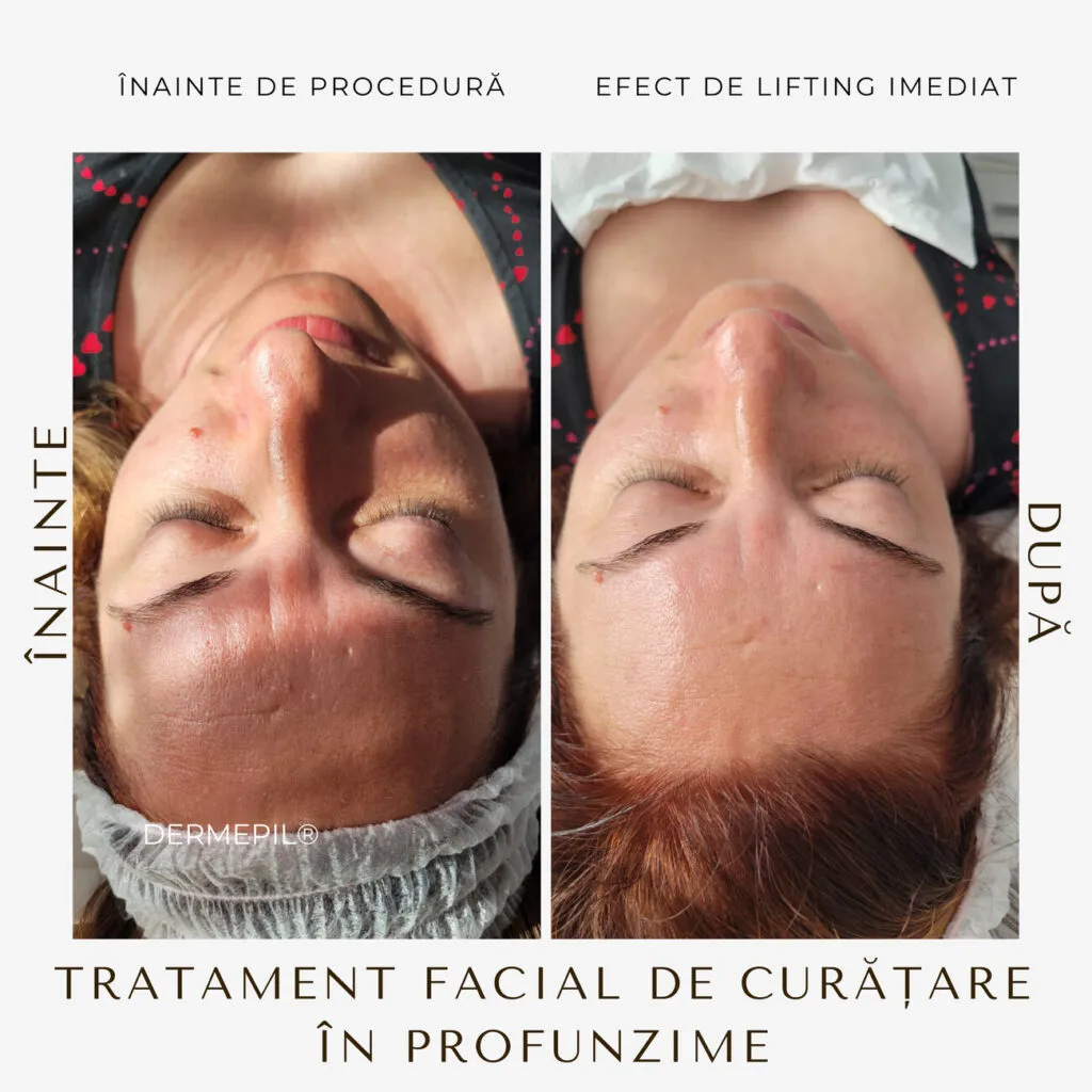tratament facial curatare 7.png