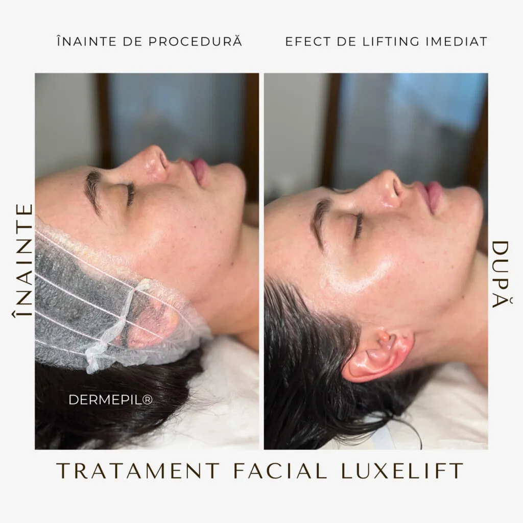 tratament facial curatare 9.png