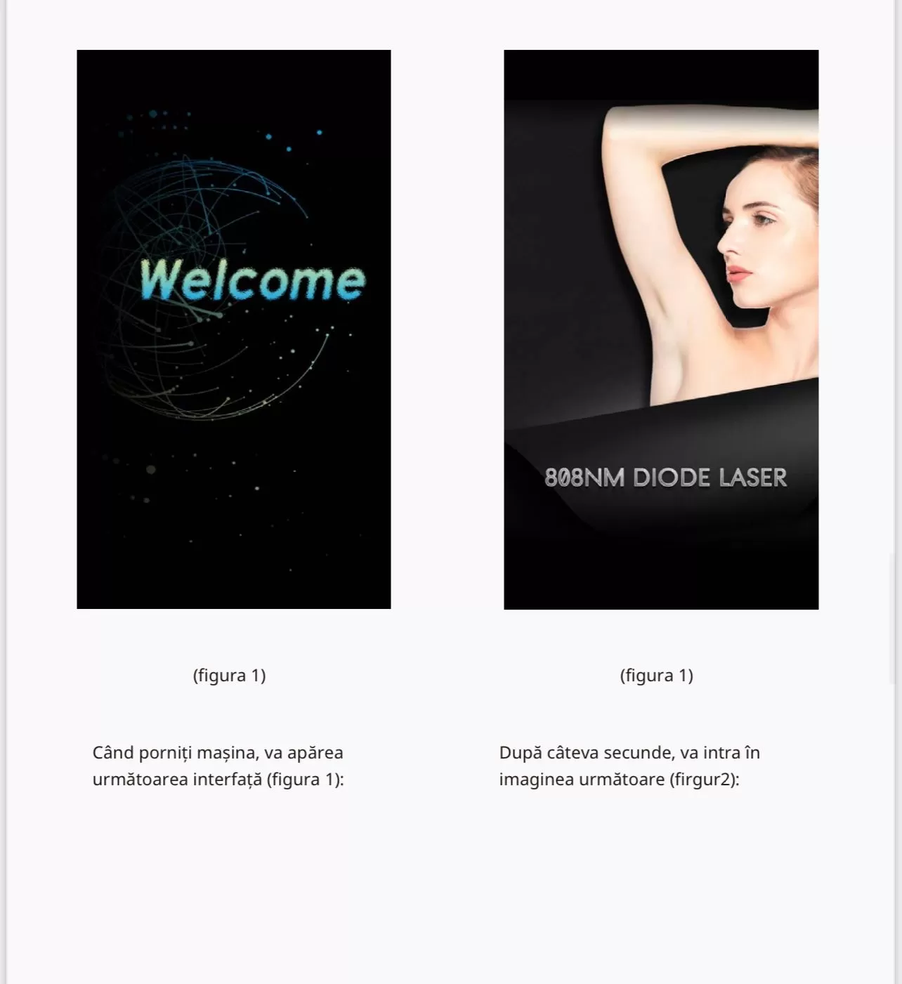 Aparat de Epilare Definitiva cu Laser Dioda cu 4 lungimi de unda - imagine 5