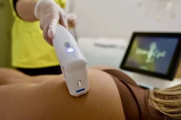 HiFU/Liposonix Fese