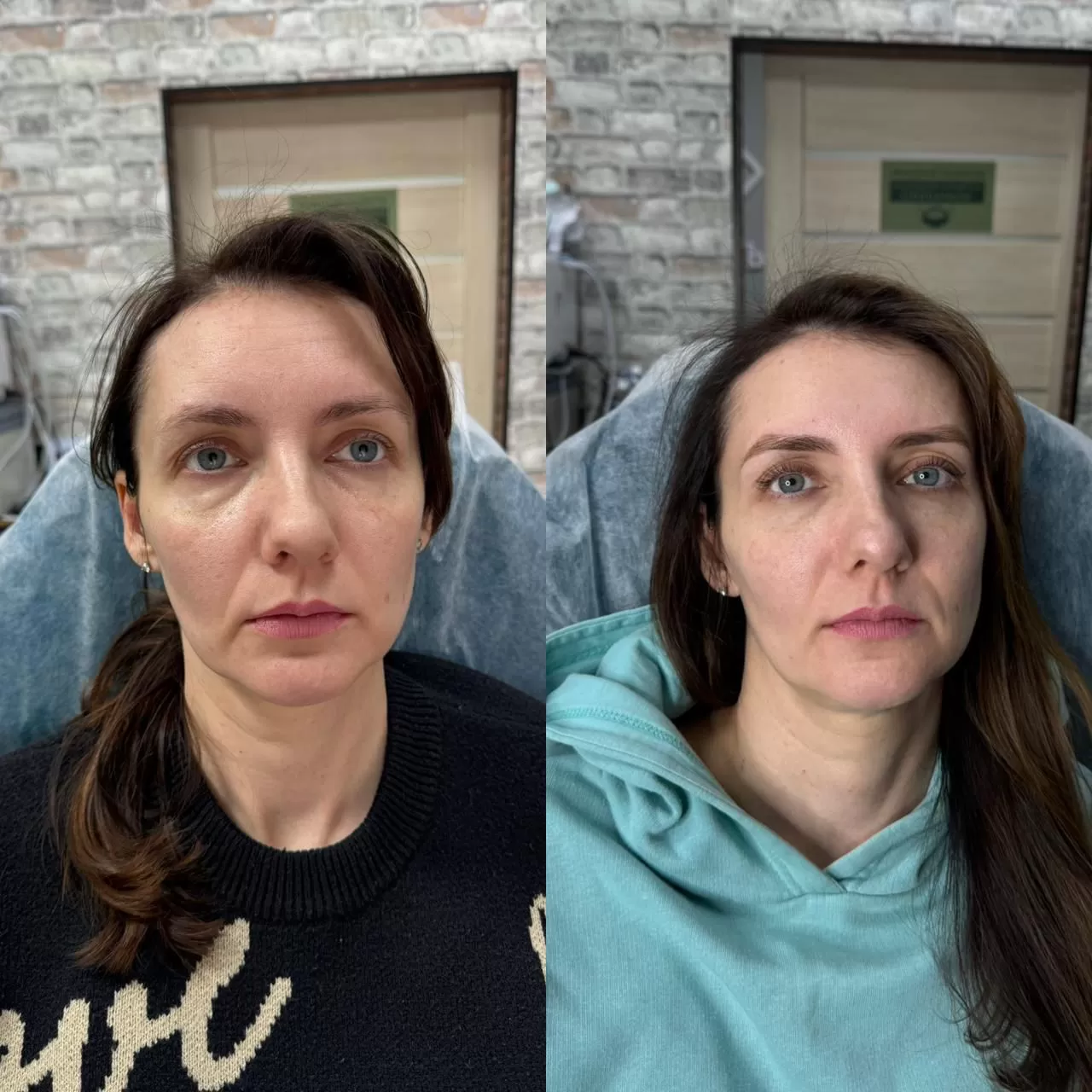 HiFU Gușă - imagine 6