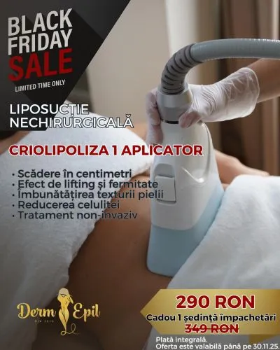 Black Friday Criolipoliză (1 aplicator)