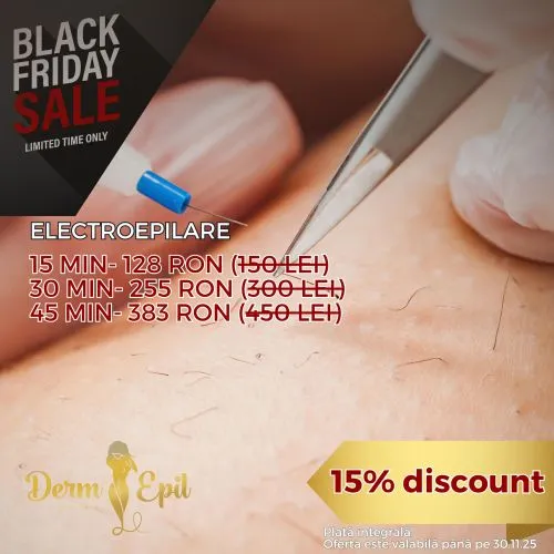 ElectroEpilare 30 minute