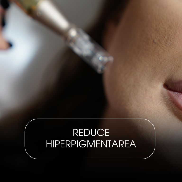 Microneedling cu Exozomi (Față & Gât)