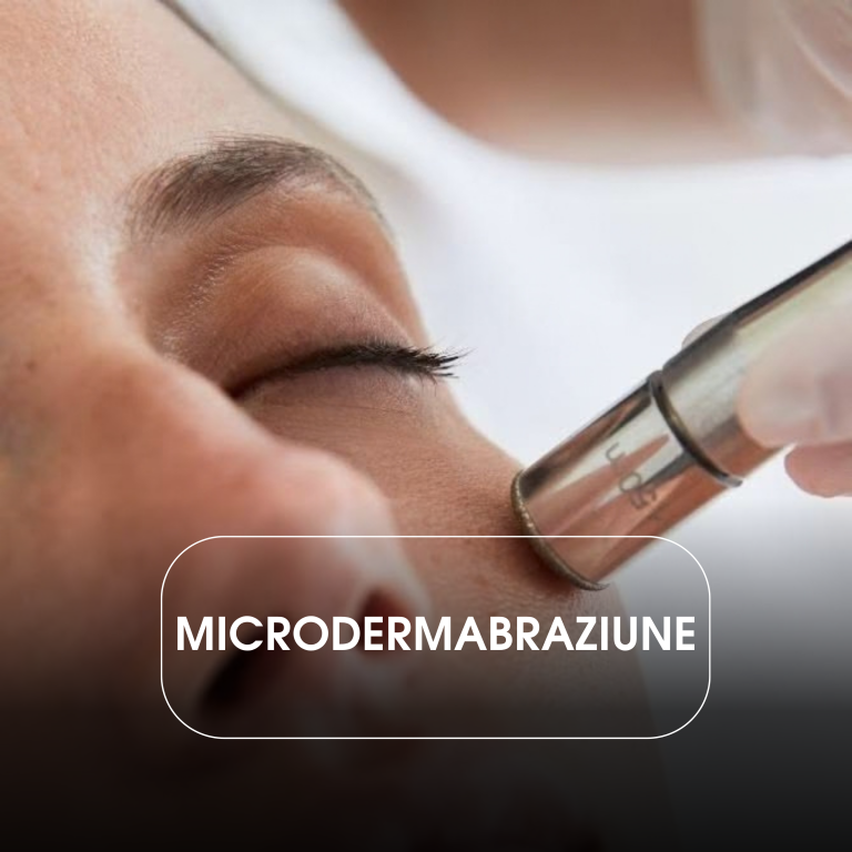 Microdermoabraziune (30 min)