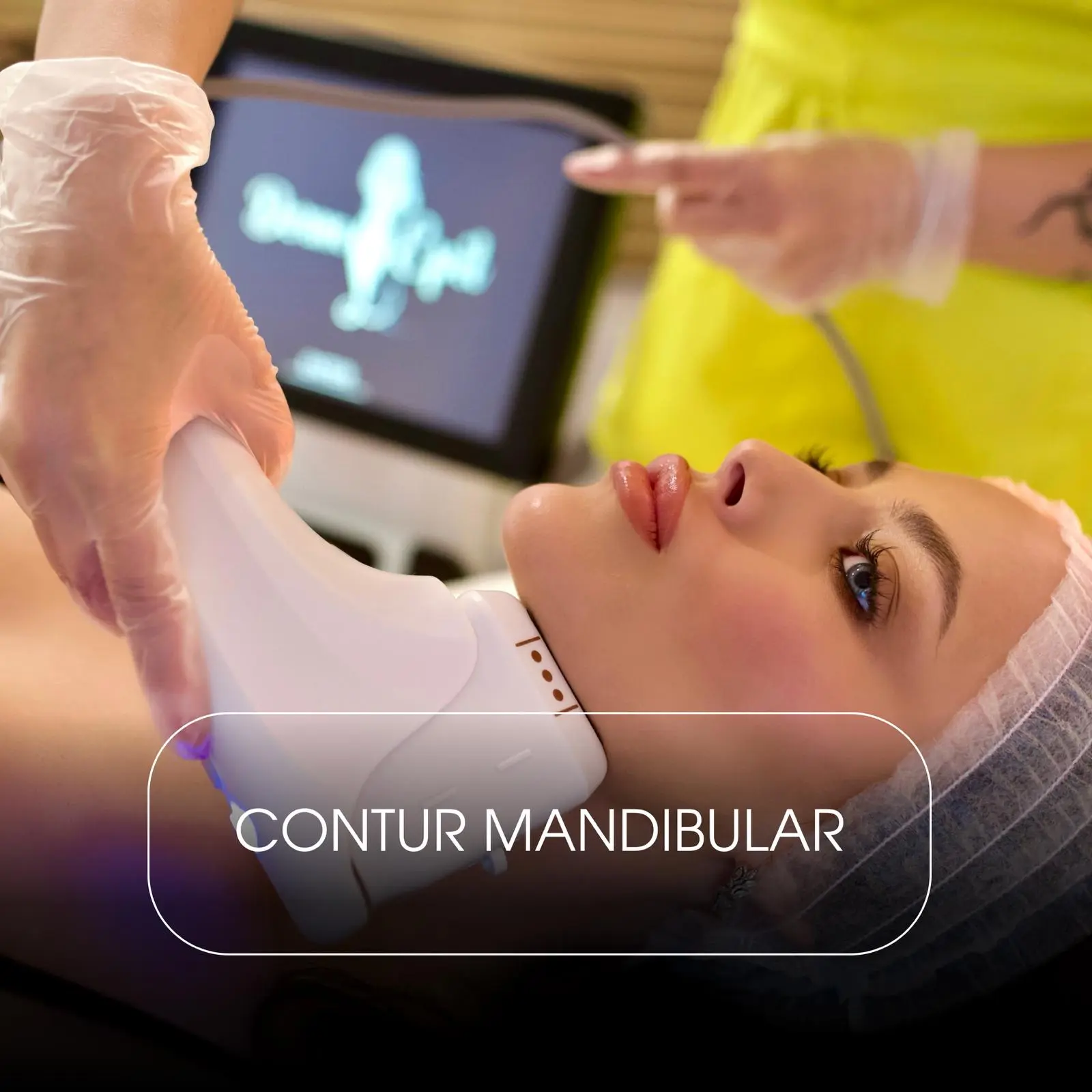 HiFu Contur Mandibular