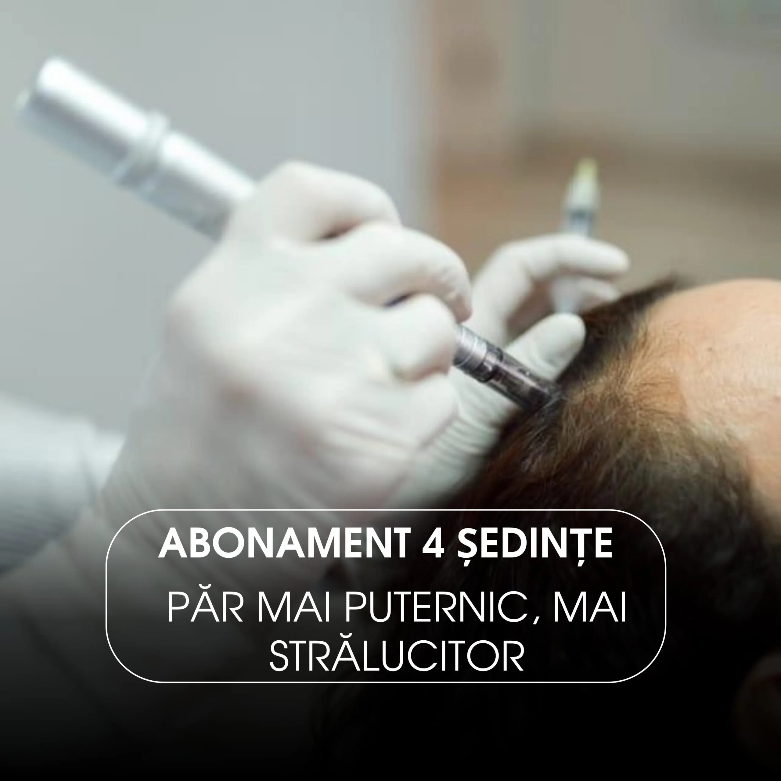 Abonament 4 Ședințe Microneedling Scalp cu Exozomi