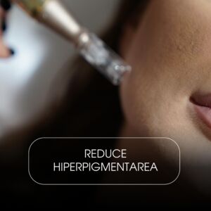 Microneedling cu Exozomi – Față & Gât