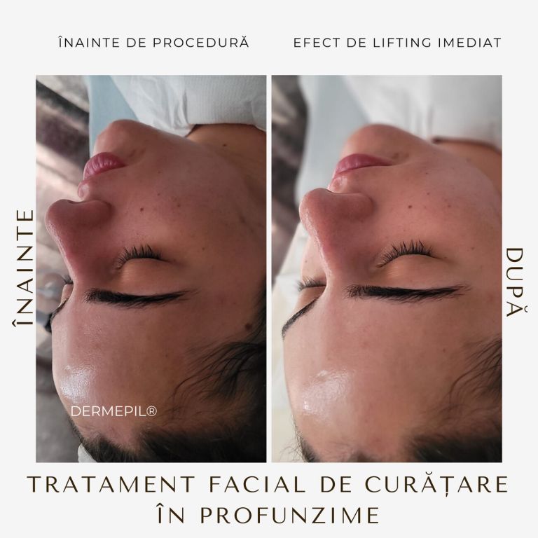 tratament-facial-curatare-1.png.jpg