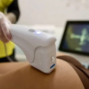 HiFU/Liposonix Fese