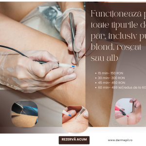 ElectroEpilare 60 minute