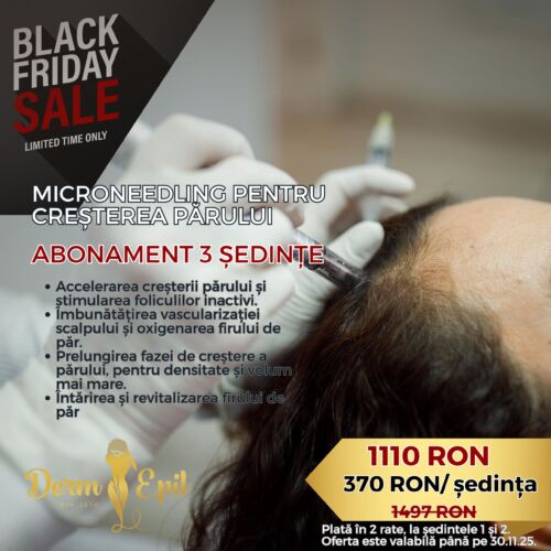 BlackFriday Microneedling pentru Creșterea Părului Abonament 4 Ședințe