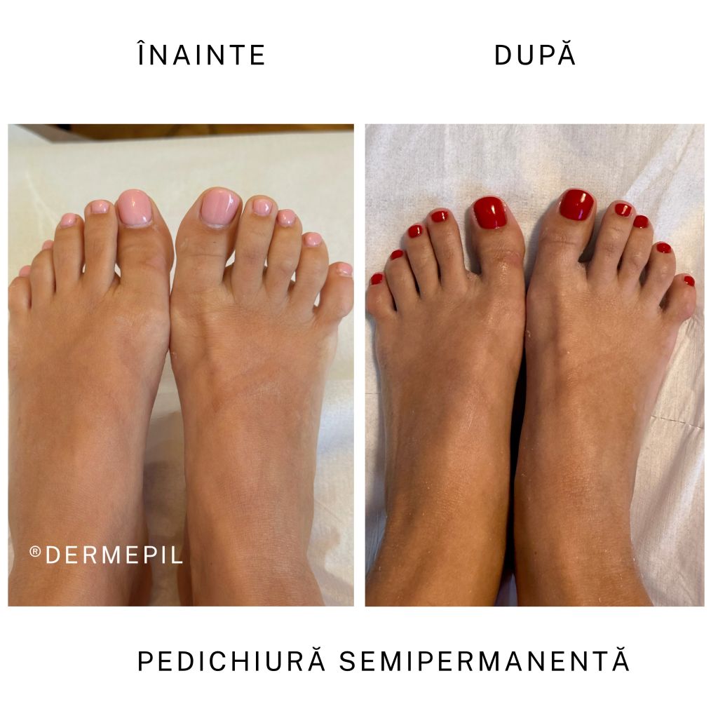 manichiura pedichiura dermepil universitate 6