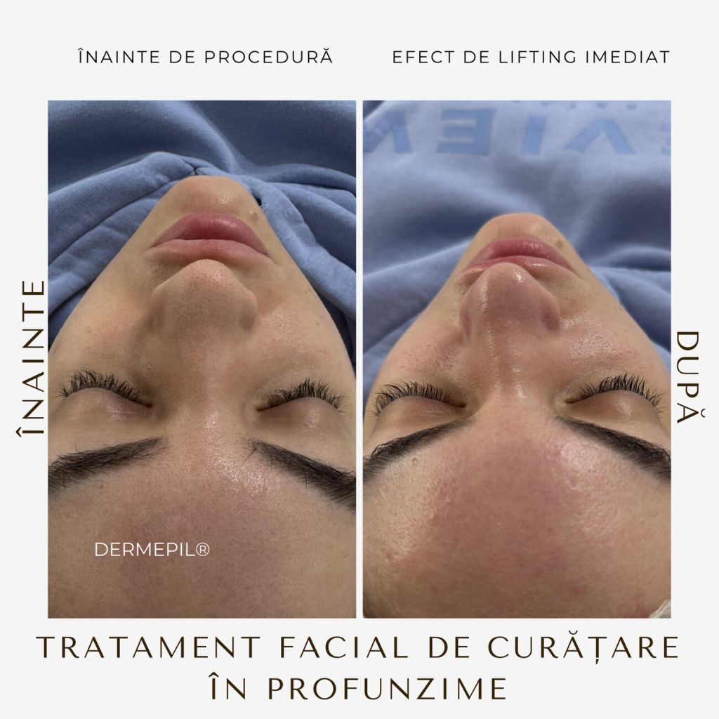 tratament-facial-curatare-4.png.jpg