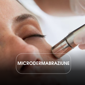 Microdermoabraziune (30 min)