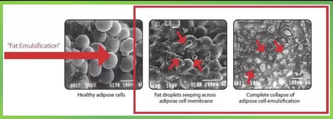1 Ședință Lipogrim Laser + Electrostimulare - imagine 6