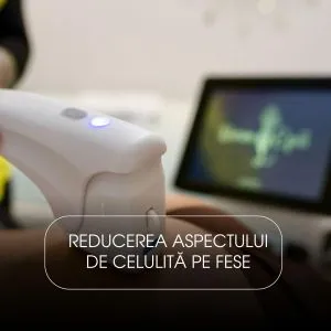HiFU/Liposonix Fese