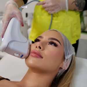 HIFU VMAX – Față Total + Gât + Mască - imagine 2