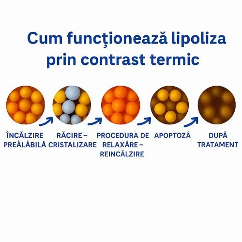 Abonament 3 sedinte Lipoliza cu soc termic 2 Aplicatori